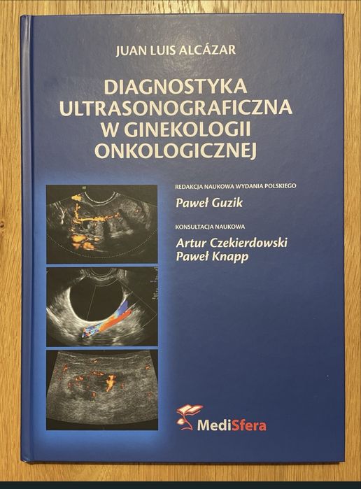 Diagnostyka ultrasonograficzna w Ginekologii Onkologicznej.