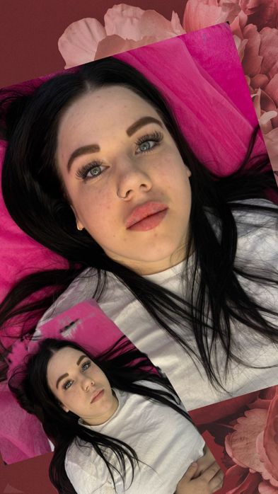 Увеличения Губ Контурная пластика,ботокс