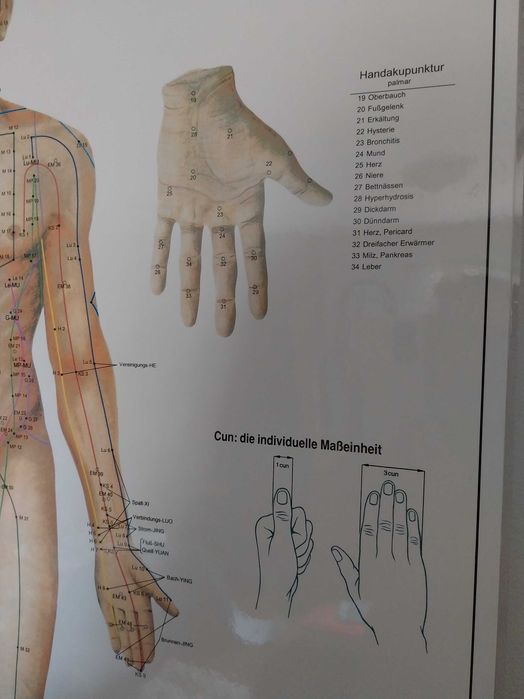 Posteres acupuntura