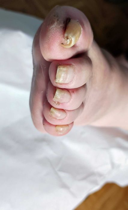 Podolog z dojazdem do domu, pedicure