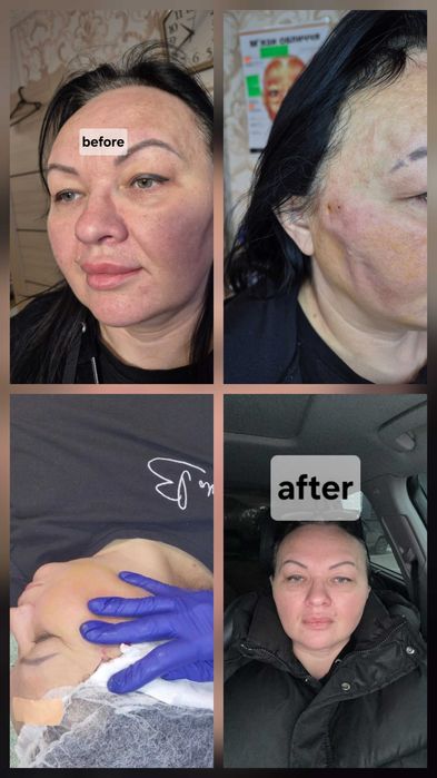 Услуги врача косметолога