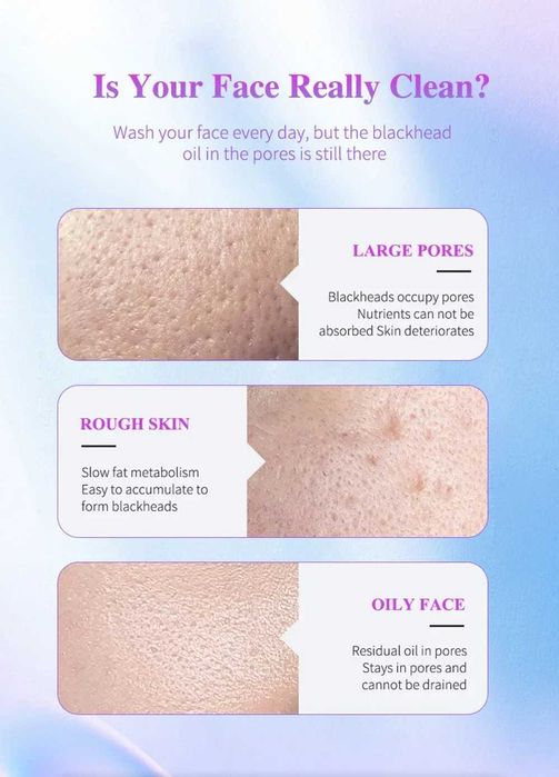 Aparelho de Limpeza Facial Ultrassónico 3 em 1 Renovador de Pele *NOVO