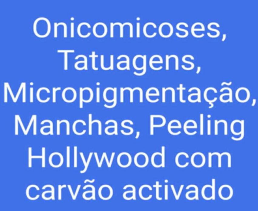 LASER YAG PICO - Tatuagens, Onicomicoses, Peeling Hollywood..