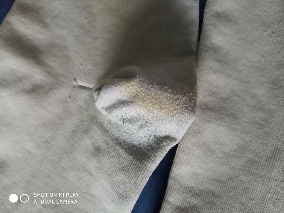 Гольфы компрессионные SIGVARIS (Швейцария), размер L, компрессия 2,беж