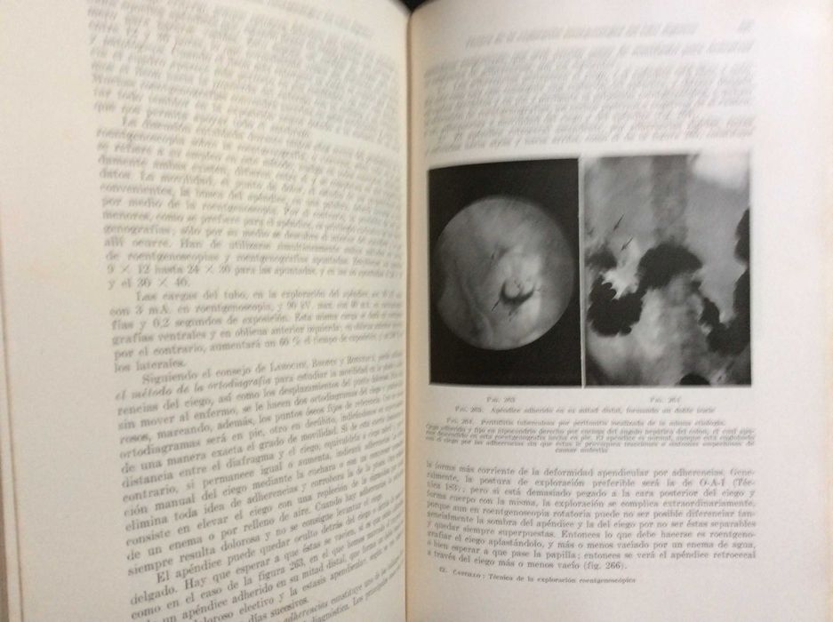 Técnica de la exploración roentgenoscópica y roentgenográfica , 1944