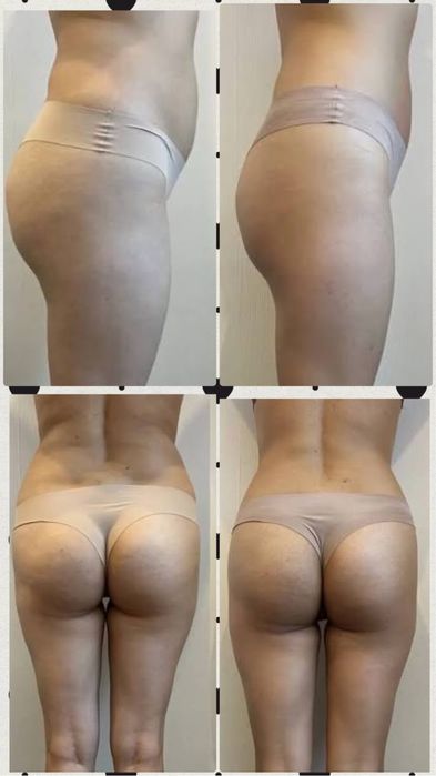 Пропоную Масаж обличча і тіла.