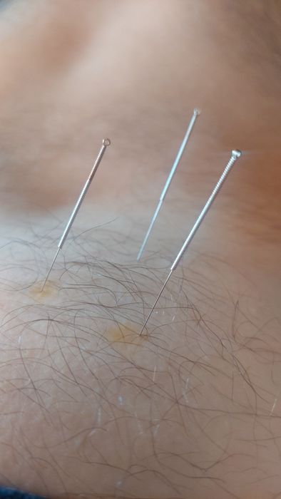 Масаж та Реабілітація: Стоун-терапія, Вакуум, Дитячий,Обличча