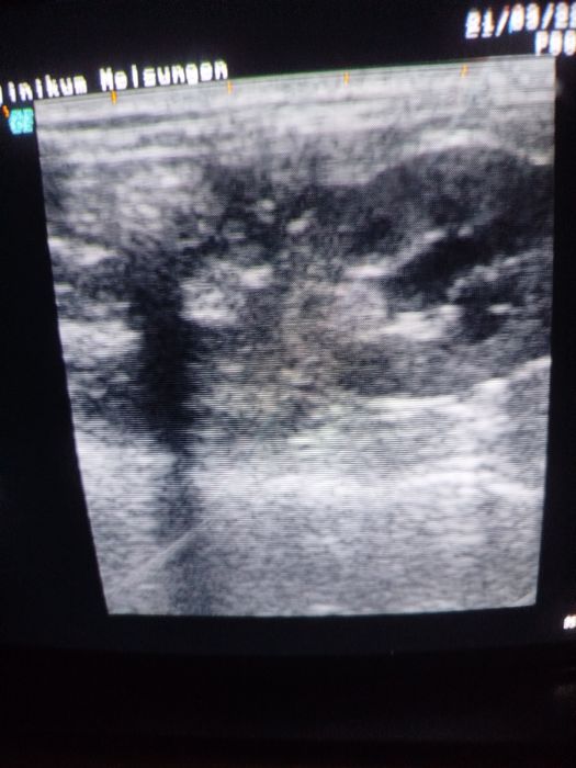 Апарат УЗД logioq 400 md