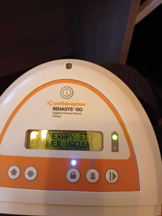 Pompa do podciśnieniowego leczenia ran Renasys Go
