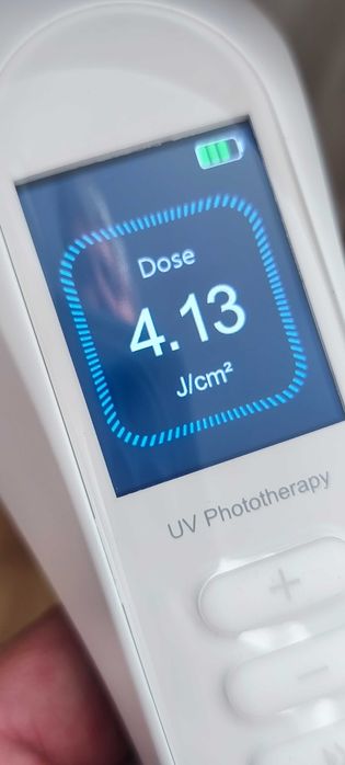 Fototerapia UVB 308nm Profissional (Vitiligo/Psoríase)