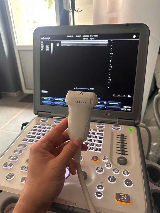 USG mobilne Mindray M6 + Sonda Liniowa Zestaw