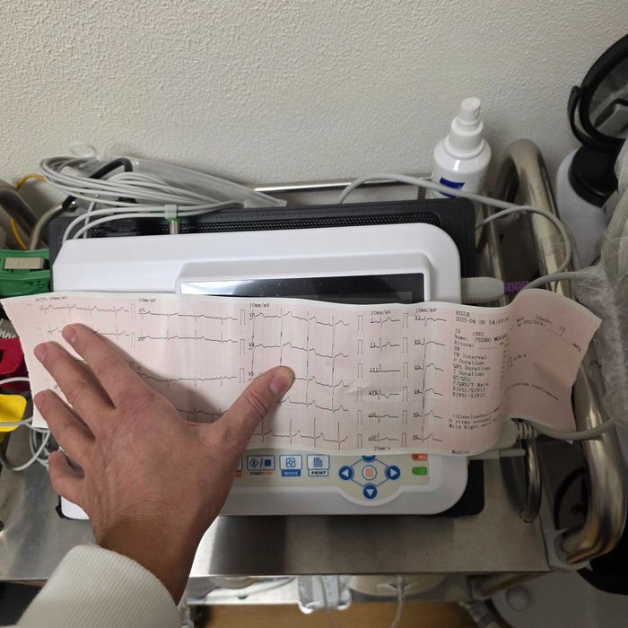 Ecg Contec 600G eletrocardiógrafo