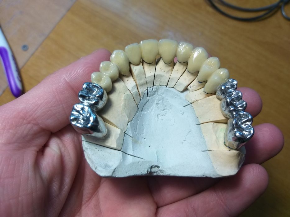 Зубний технік. Зуботехнічна Лабораторія  "Dental LAB"