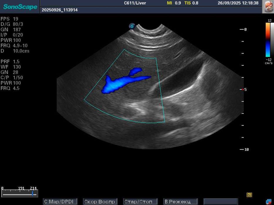 УЗИ\УЗД апарат SonoScape S8-Exp/Соноскейп/4 датчики/Еластографія/3D-4D