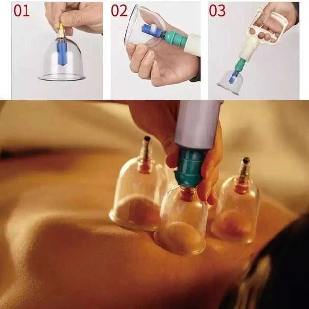 Набір вакуумних банок, Банки для вакуумного масажу,Антицелюлітні банки