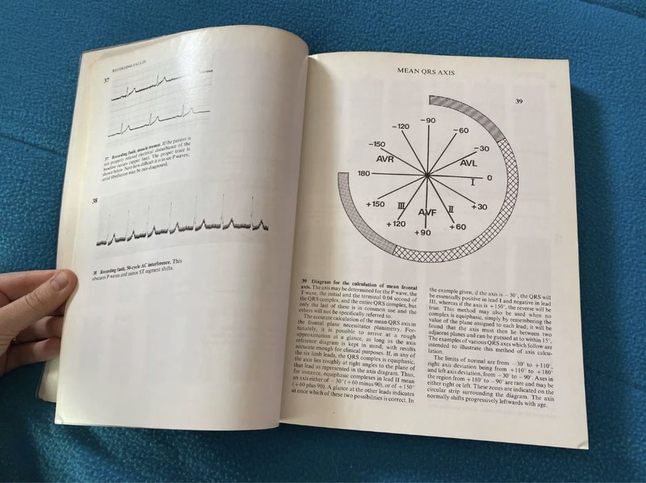 Livro - Atlas of CARDIOLOGY Electrocardiograms and Chest X-Rays