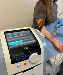 Лазер высокой интенсивности BTL-6000 мощностью 12 Вт