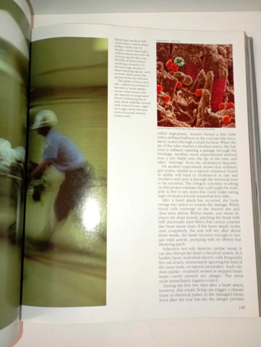 The Incredible Machine