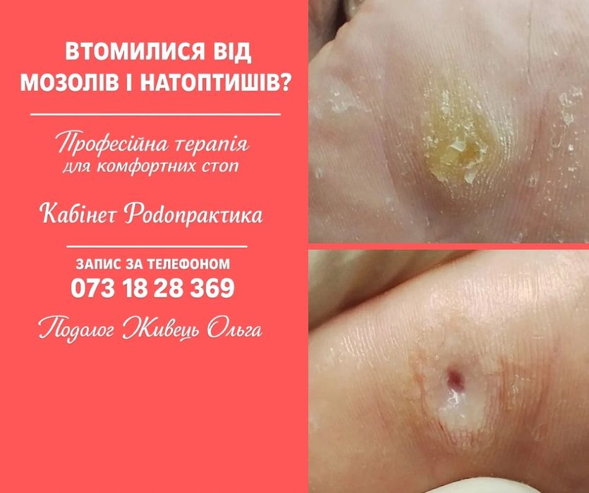 Сучасний подолог