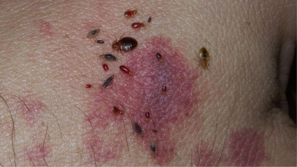 Fumigacja Gazowanie Zboża Dezynsekcja Deratyzacja Dezynfekcja Szczury