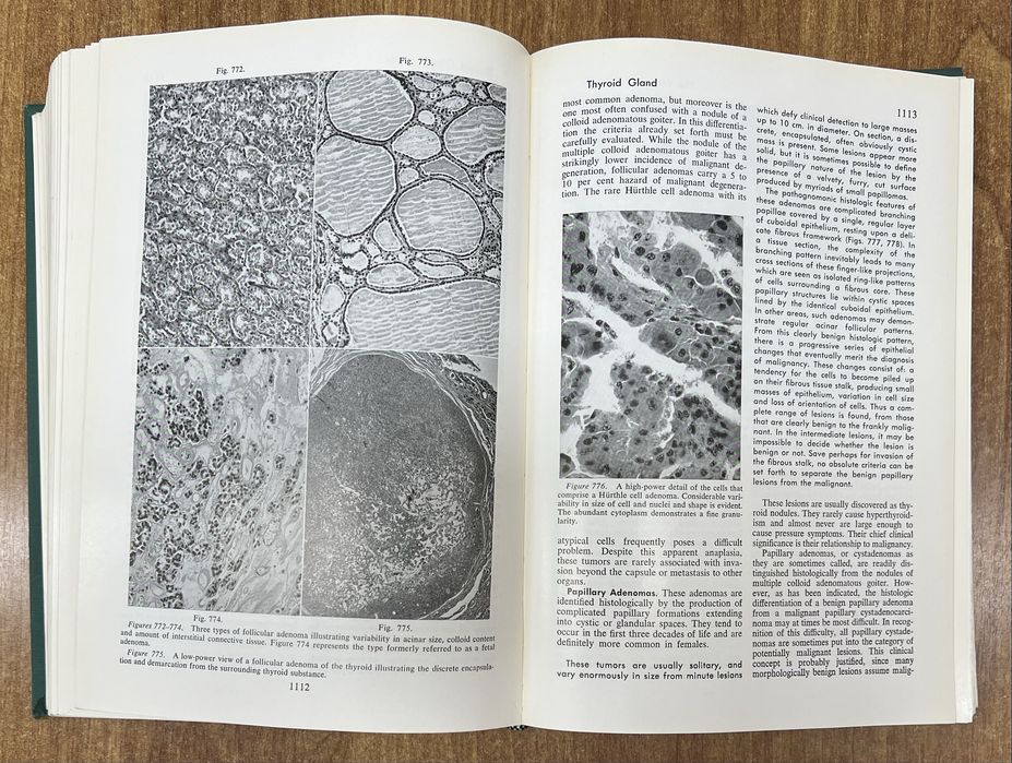«Textbook of Pathology» Stanley L. Robbins, 1st Ed. «Патологія»