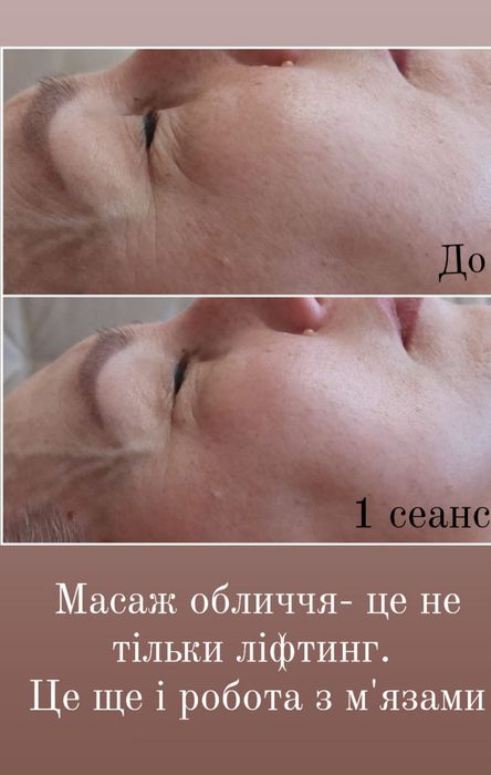 Масаж обличчя комплексний , Ірпінь 7 Лінія