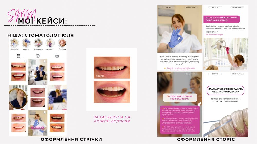 СММ, просування Instagram для стоматологів, бізнесу