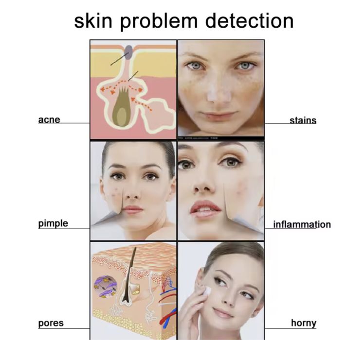 Діагностична машина для шкіри голови, Трихоскоп, Мікроскоп