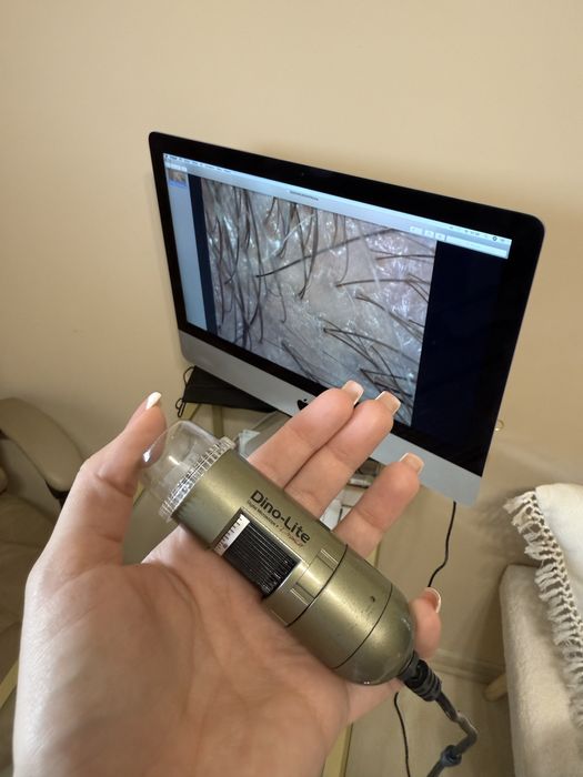 Kamera trychologiczna Dinolite trychoskop