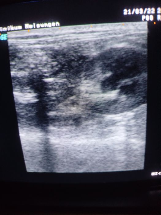 Апарат УЗД logioq 400 md