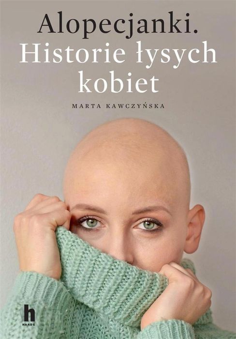 Alopecjanki. Historie łysych kobiet. Harde Marta Kawczyńska Rok