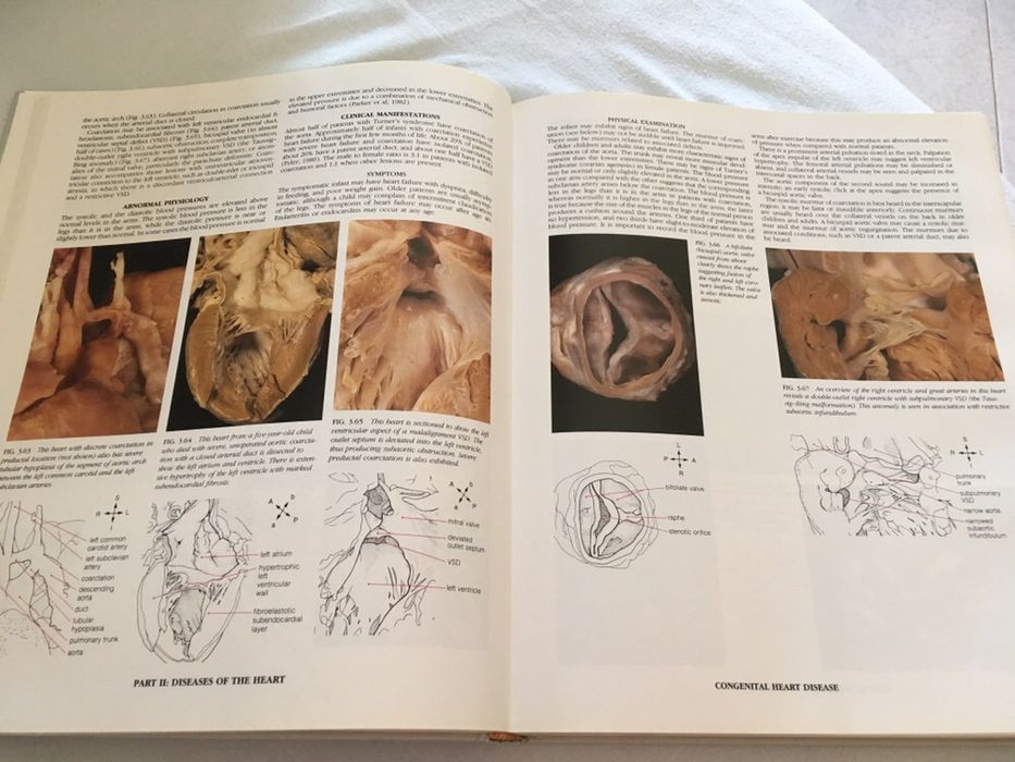 Vendo livro "Atlas of the Heart"