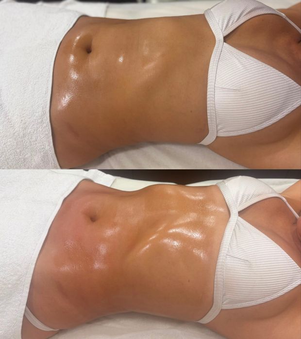 Massoterapeuta  e esteticista