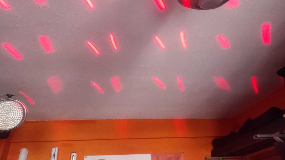 Derby - Showtec x ray