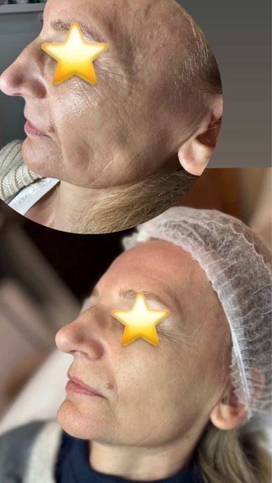 Dyskretna zmiana. Wyraźny efekt.