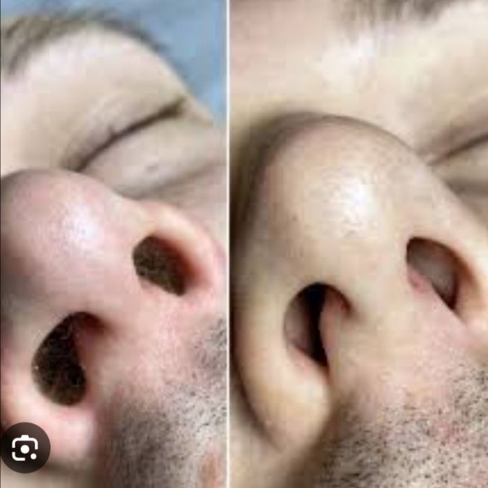 Шугаринг, депиляция, воск, Краматорск