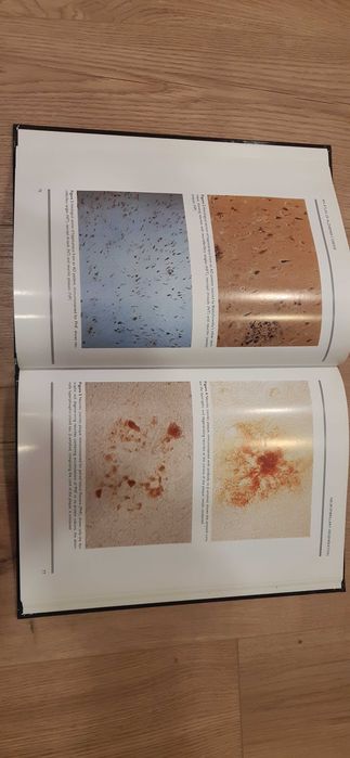 Livro Atlas of Alzheimer's disease