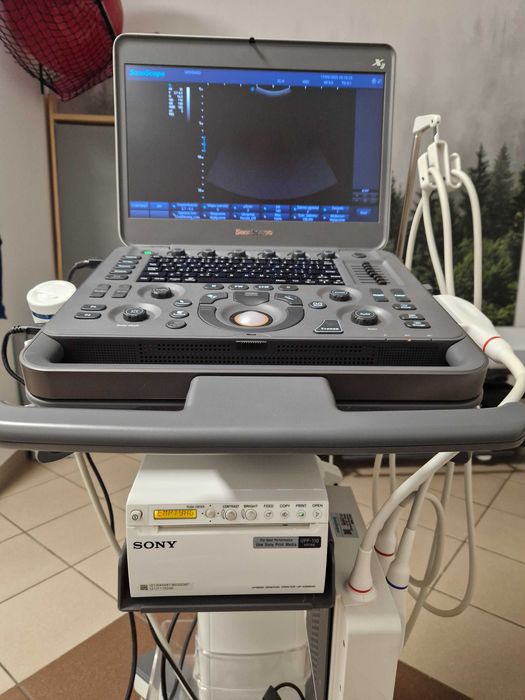 Sonoscape X3 – mobilny aparat USG klasy premium z dwiema głowicami!