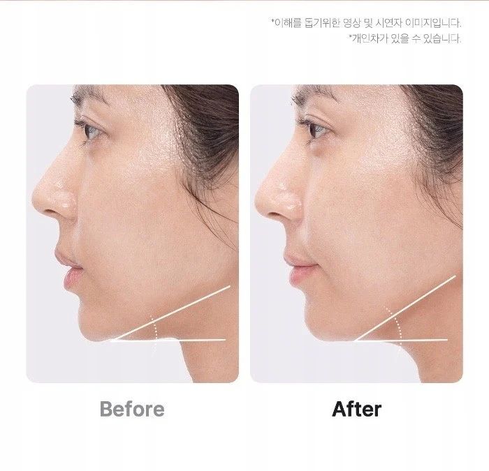 Medicube AGE-R Booster Pro 6 in 1