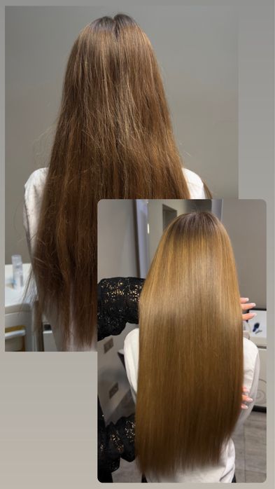 Ботокс. Холодне відновлення,вихід с черного