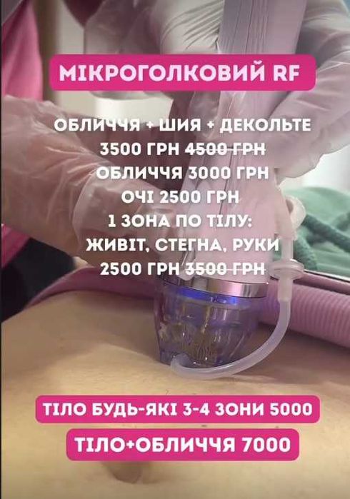 Косметолог,Биоревитализация.  Мезотерапия, Соломʼянка, Київ.