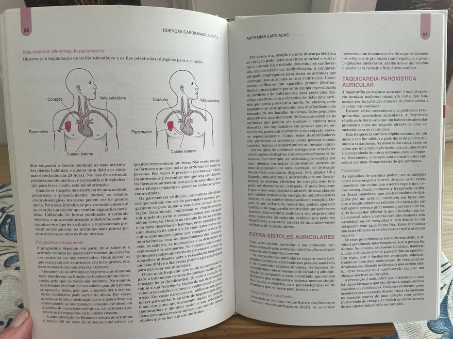 Doenças Cardiovasculares - Enciclopédia Médica - Volume 1