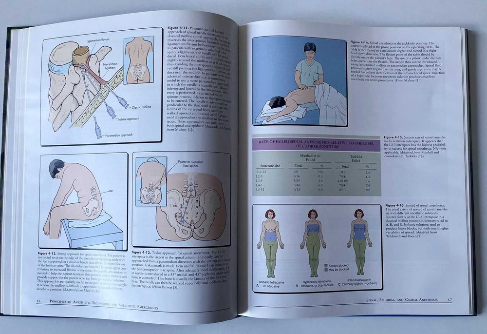 Atlas of anesthesia - Volume IV