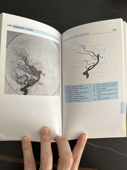 Atlas de Anatomia Radiológica