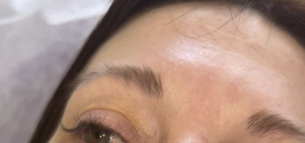 Збільшення губ 1500/3000 | лікар косметолог | моделі