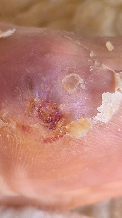 Enfermeira ao domicilio