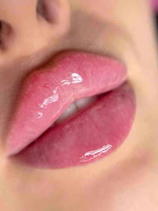 АКЦИЯ СКИДКИ Нужны МОДЕЛИ на увеличение губ для портфолио