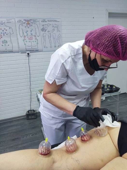 Обучение Хиджаме в Киеве. 70%  практика, постановка рук на моделях
