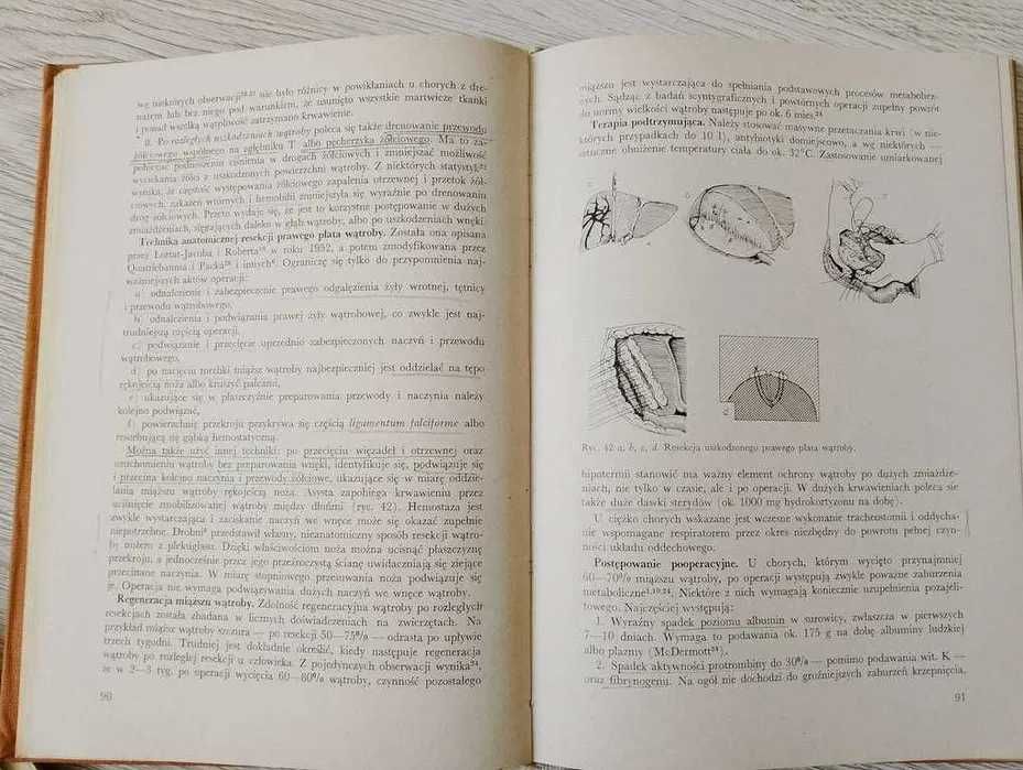 Chirurgia wątroby i dróg żółciowych red. J.Kubiak / MEDYCYNA