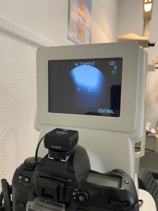 Retinografo kowa nonmyd 7
